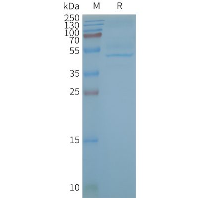 page-FLP100138 CB2 Fig.2 SDS PAGE 1