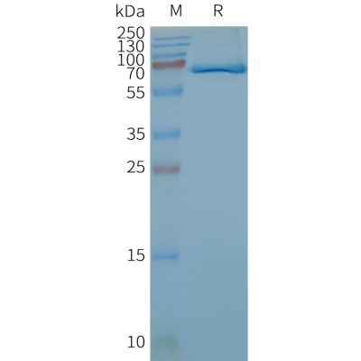 page-FLP100139 FZD4 Fig.2 SDS PAGE 1