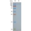 page-FLP100141 TLR4 Fig.2 SDS PAGE 1