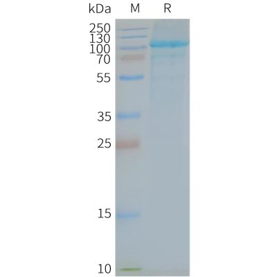 page-FLP100143 TLR5 Fig.2 SDS PAGE 1