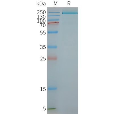 page-FLP100147 PLA2R1 Fig.2 SDS PAGE 1