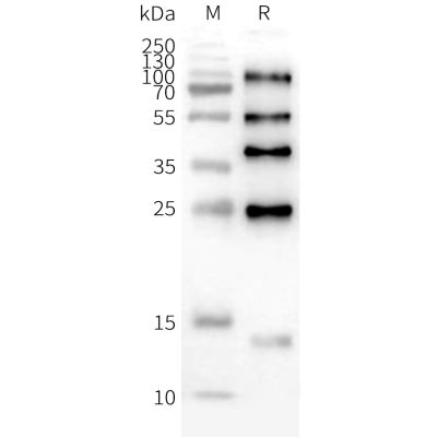 page-FLP100148 ILDR2 Fig.2 SDS PAGE 1