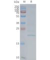 page-FLP100149 EMP2 Fig.2 SDS PAGE 1