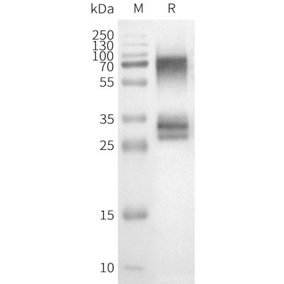 page-FLP100150 OR3A1 Fig.2 SDS PAGE 1