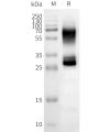 page-FLP100151 OR2B3 Fig.2 SDS PAGE 1