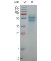 page-FLP100157 ADRB1 Fig.2 SDS PAGE 1