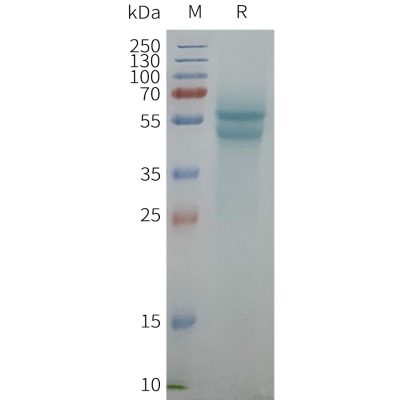 page-FLP100157 ADRB1 Fig.2 SDS PAGE 1