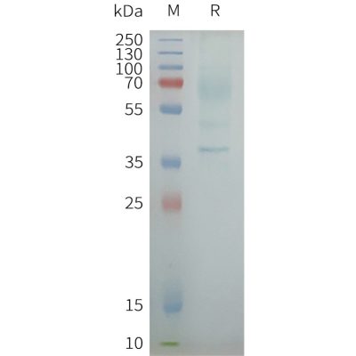 page-flp100429 oxyr sp1