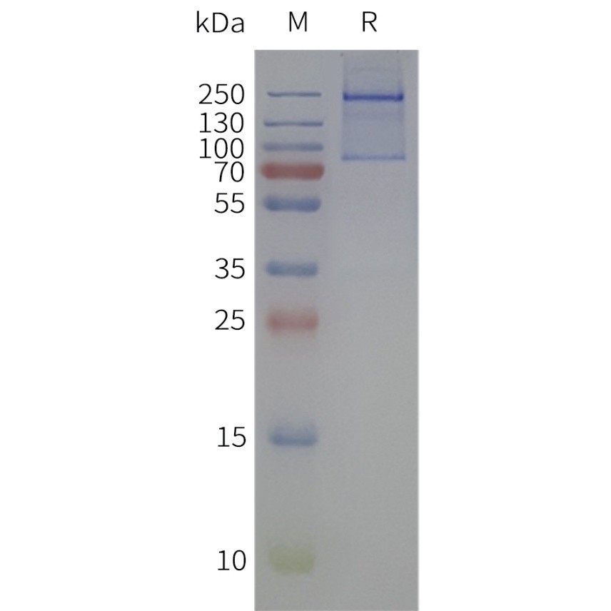 flp100501-ptprz1-sp1.jpg