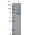 page-flp120013 sstr2 strep sp1