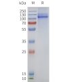 page-flp120128 trpv1 strep sp1