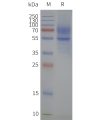 page-flp120161 5ht1a strep sp1