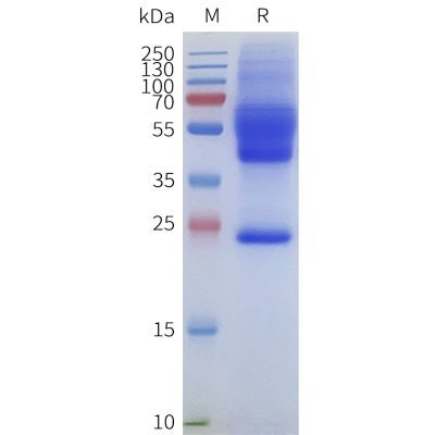 page-flp120175 ackr1 strep sp1