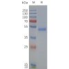 page-flp120232 drd4 strep sp1