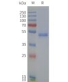 page-flp120232 drd4 strep sp1