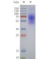 page-flp120253 galr1 strep sp1