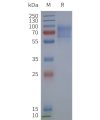 page-flp120278 gpr161 strep sp1