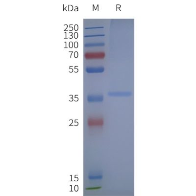 page-flp120291 gper1 strep sp1