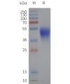 page-flp120328 hcar2 strep sp1