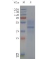 page-flp120345 mc3r strep sp1