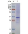page-flp120354 mc1r strep sp1