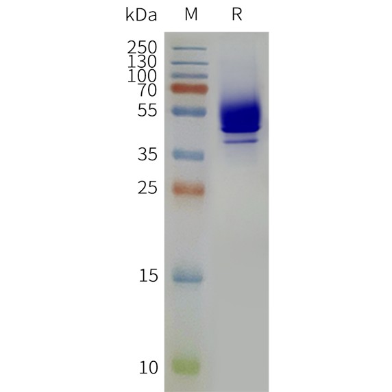 flp120460-s1pr1-strep-sp1.jpg