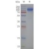 page-flp120496 slc34a2 strep sp1