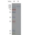 page-flp120501 kcnh2 sp1