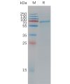 sp-PME C100012 ADAM9 Fig.1 SDS PAGE 1