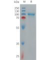 sp-PME C100014 CD93 Fig.1 SDS PAGE 1