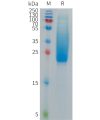 sp-PME C100015 IL18BP Fig.1 SDS PAGE 1