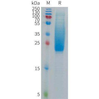 sp-PME C100015 IL18BP Fig.1 SDS PAGE 1