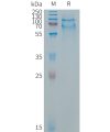 sp-PME C100016 SELPLG Fig.1 SDS PAGE 1