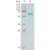 sp-PME C100017 ALPP Fig.1 SDS PAGE 1