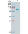 sp-PME C100017 ALPP Fig.1 SDS PAGE 1