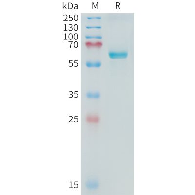 sp-PME C100017 ALPP Fig.1 SDS PAGE 1