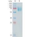 sp-PME C100018 B7 H3 Fig.1 SDS PAGE 1