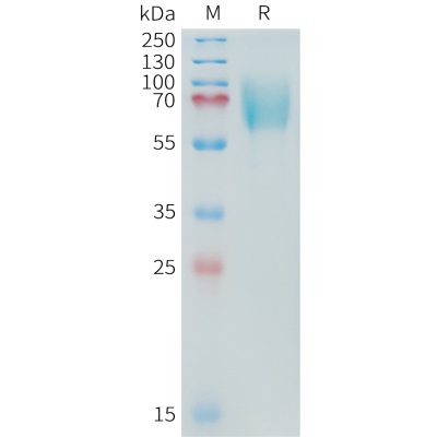 sp-PME C100018 B7 H3 Fig.1 SDS PAGE 1