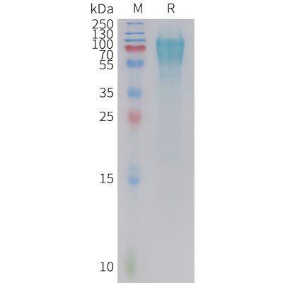 sp-PME C100022 GUCY2C Fig.1 SDS PAGE 1