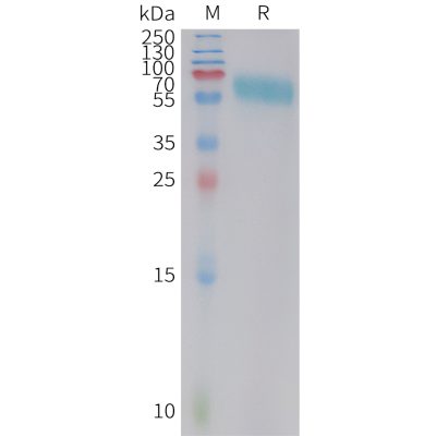 sp-PME C100023 4 1BB Fig.1 SDS PAGE 1