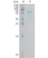 sp-PME C100024 TREM2 Fig.1 SDS PAGE 1