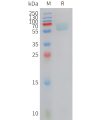 sp-PME C100025 AXL Fig.1 SDS PAGE 1