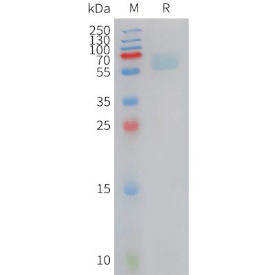 sp-PME C100025 AXL Fig.1 SDS PAGE 1