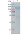 sp-PME C100029 CDH17 Fig.1 SDS PAGE 1