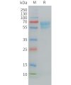 sp-PME C100030 CD7 Fig.1 SDS PAGE 1