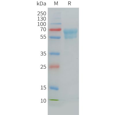 sp-PME C100030 CD7 Fig.1 SDS PAGE 1