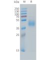 sp-PME C100031 B7 H6 Fig.1 SDS PAGE 1