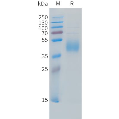 sp-PME C100031 B7 H6 Fig.1 SDS PAGE 1