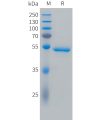 sp-PME C100032 CA9 Fig.1 SDS PAGE 1