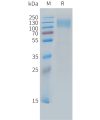 sp-PME C100033 CEACAM5 Fig.1 SDS PAGE 1